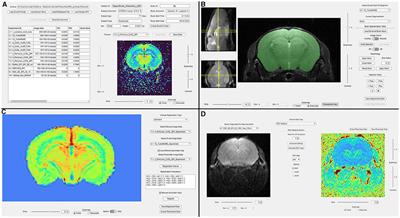 suMRak: a multi-tool solution for preclinical brain MRI data analysis